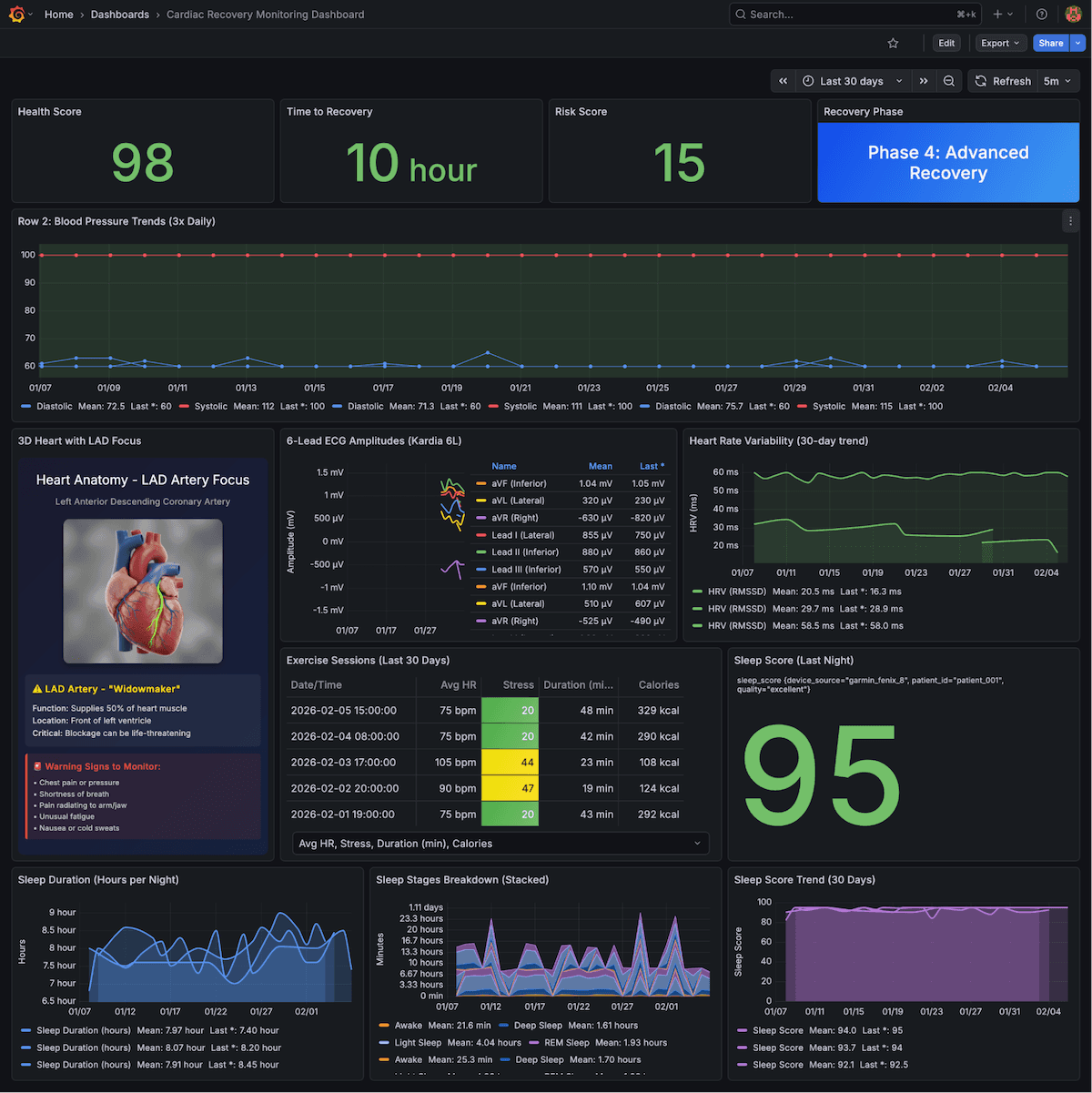 Dashboard displaying cardiac recovery metrics: heart score, exercise sessions, sleep data, and detailed graphs. Highlight on LAD artery focus.